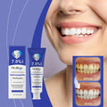 Blanchiment et réparation des dents Dentifrice 120g 1box