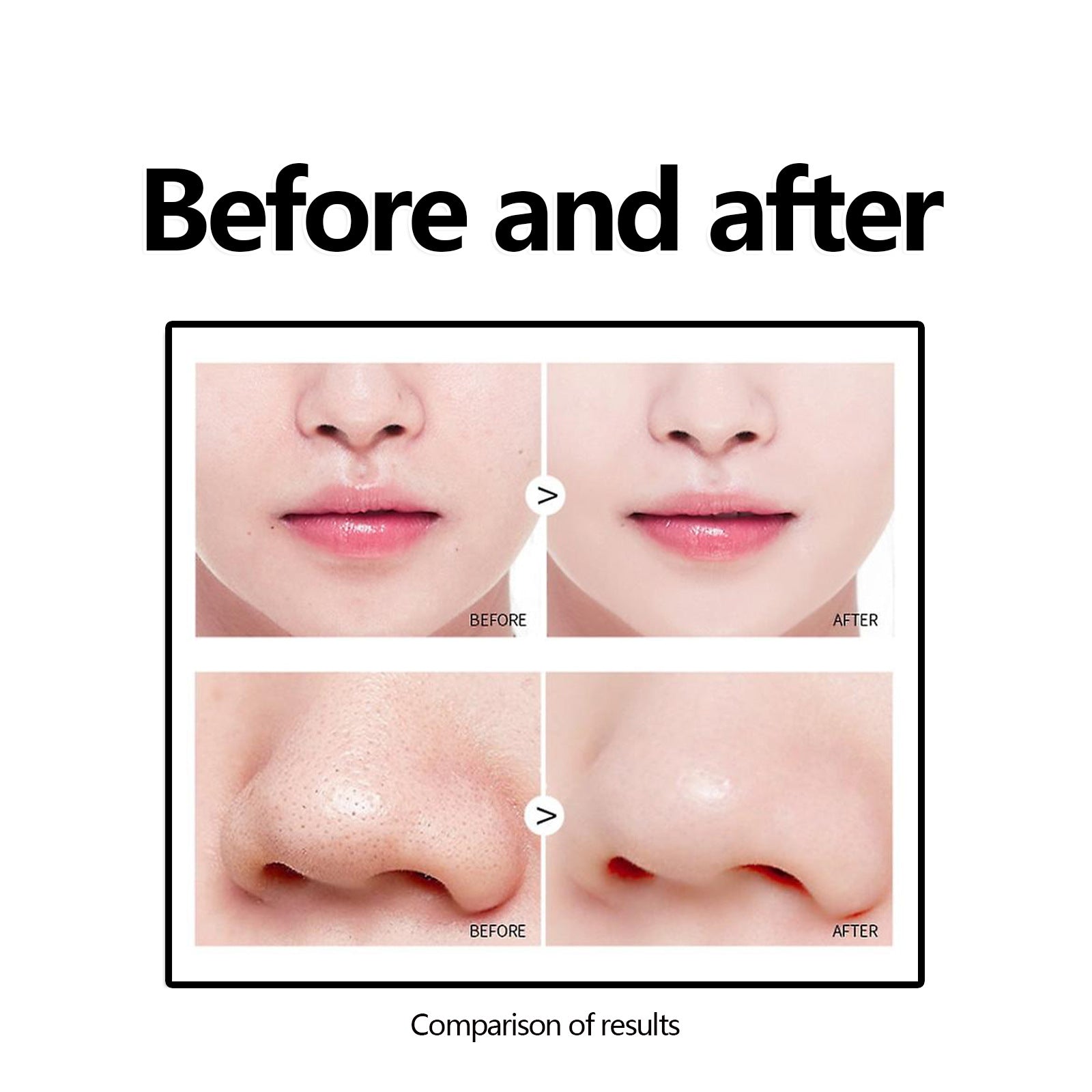 Enlèvement de la tête noire de l'ouest et du mois Masque épluchant Masque visage nettoyant profond pour la tête noire Acne Po