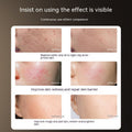 Photon IPL Device Masque de beauté LED Accueil Photothérapie Instrument de beauté