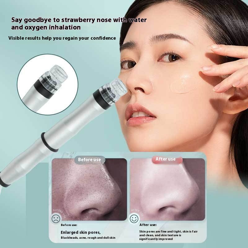 Blackhead aspiration et suppression de bulles dispositif de beauté
