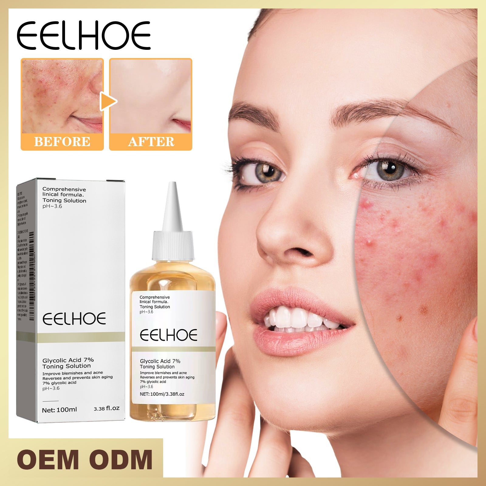 Acide glycolique 7 Toner 1 0 0ml-boîte