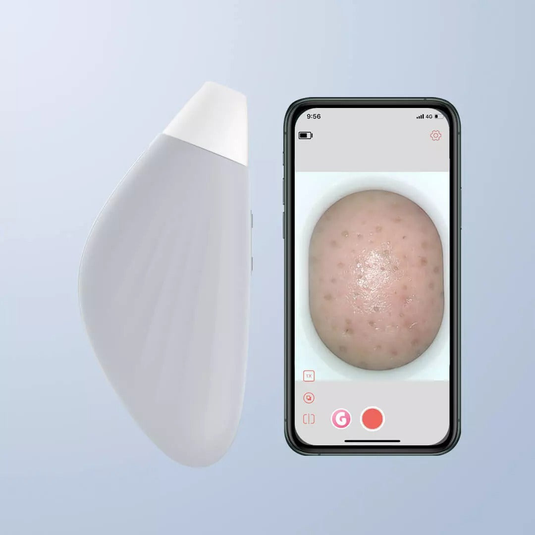 Dispositif d'aspiration de Blackhead Pore Cleaner Dispositif d'aspiration électronique de beauté de Blackhead