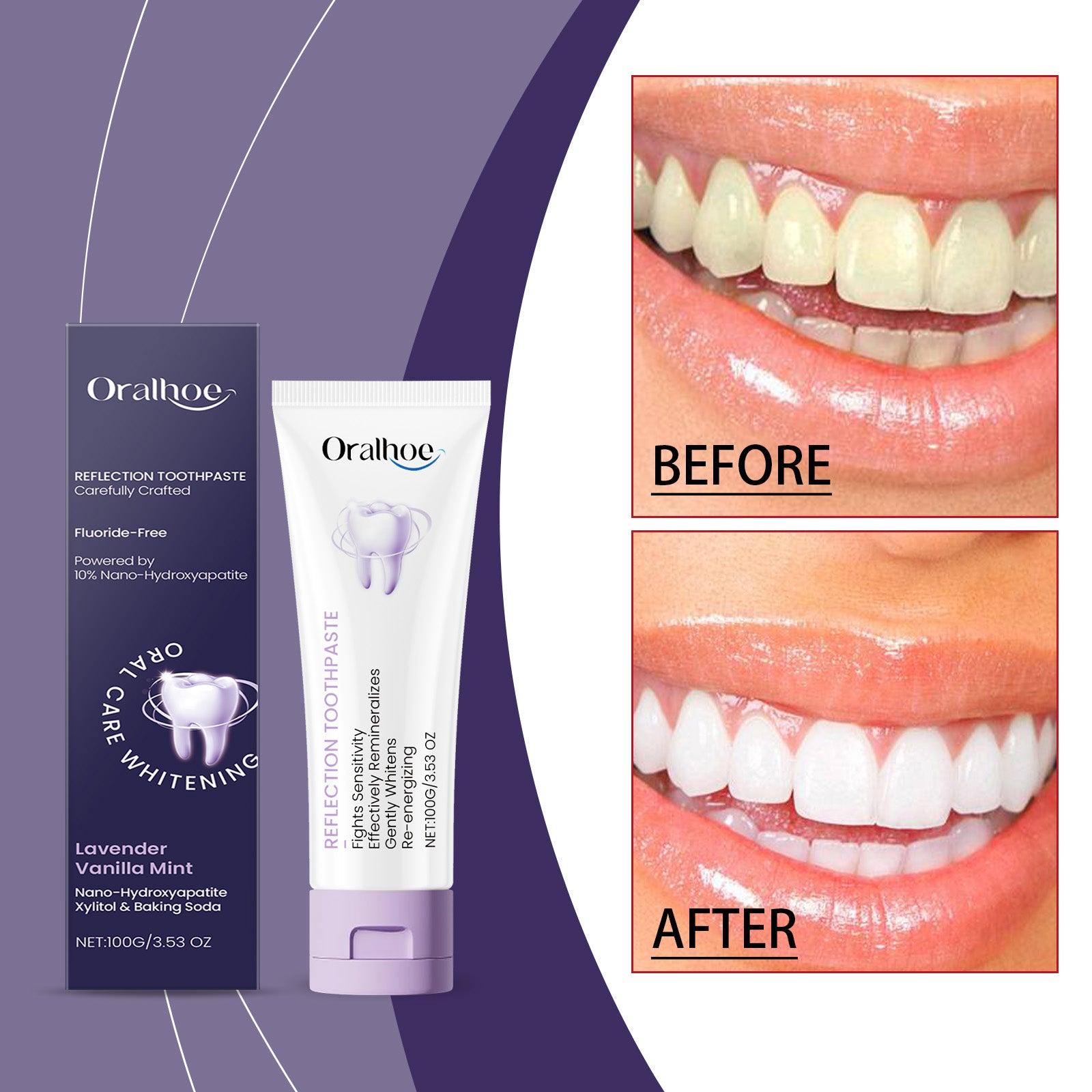 Dentifrice blanchissant le xylitol