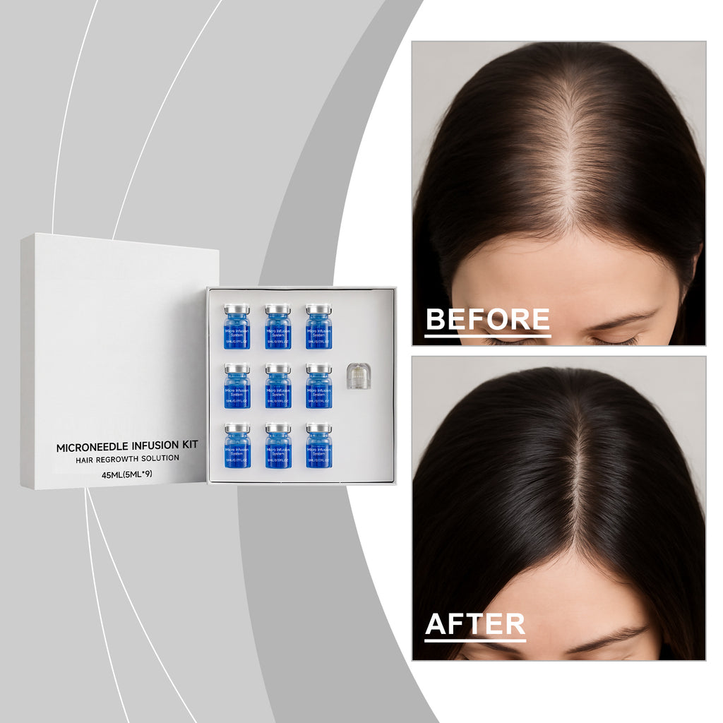 Kit scalp Sérum Microneedle Boîte 45ml