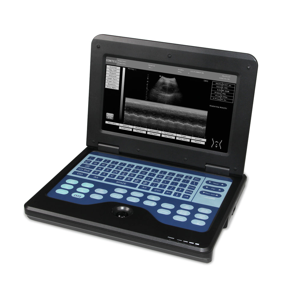Détecteur à ultrasons portatif Ordinateur portable numérique de diagnostic 3.5 Convex sonde