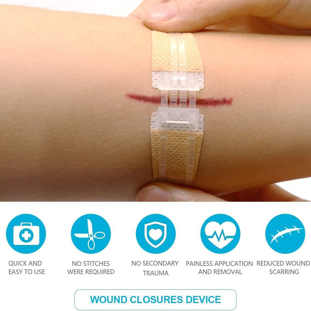 Non-tissé Zipper Skin Stapler Wound Suture Patch Pull Bande autocollante