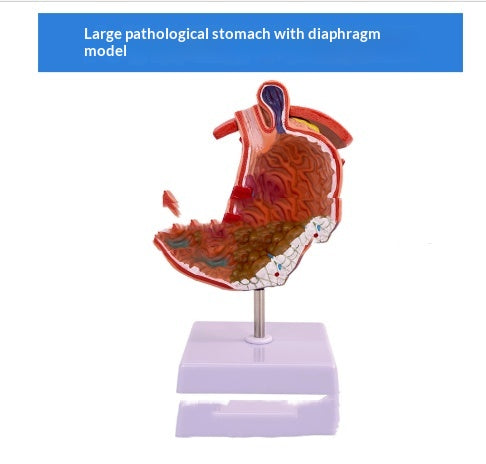 Modèle du système digestif humain Section coronale gastrique Anatomie anorectale Enseignement médical Ai