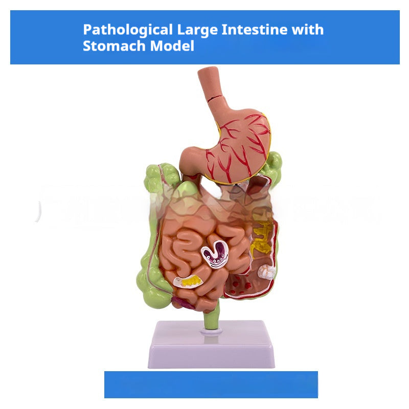Modèle du système digestif humain Section coronale gastrique Anatomie anorectale Enseignement médical Ai