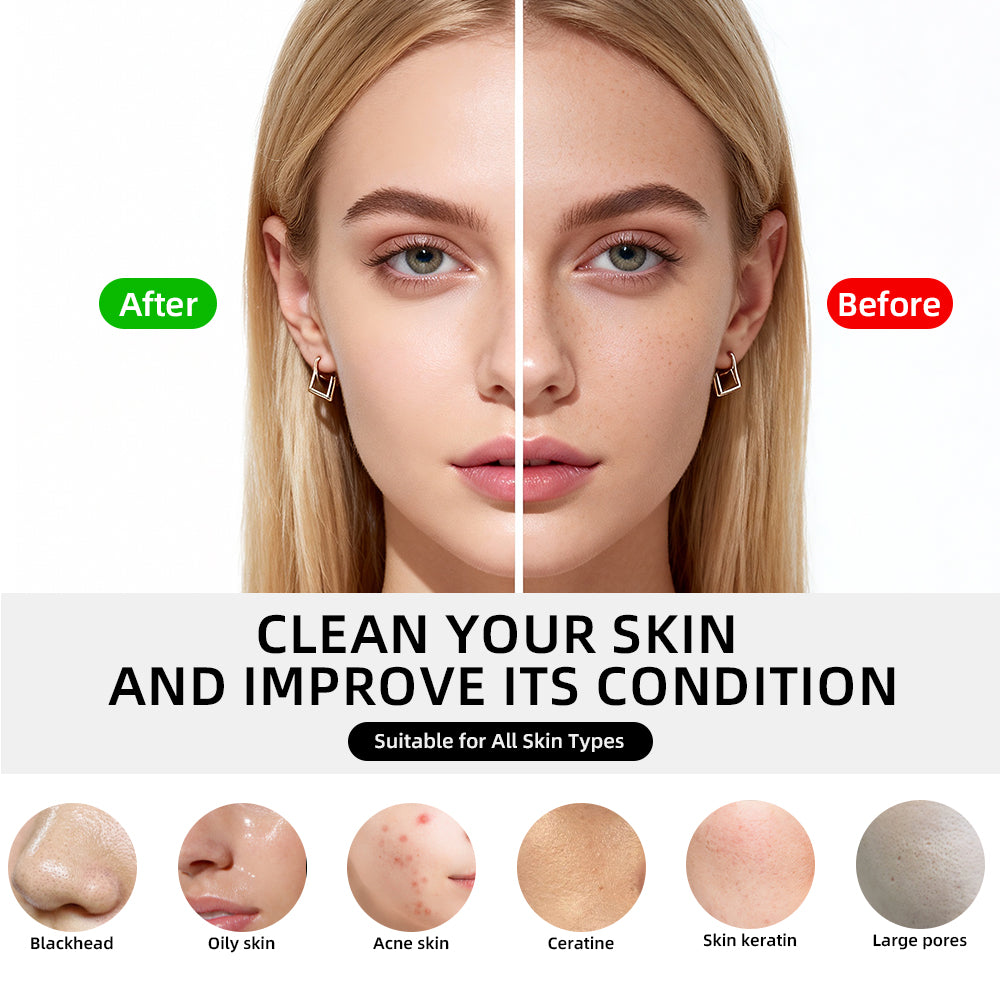 Portable Compact Cold Face Cleaner There Clean Cold Converge Pore outil de gestion pour la maison