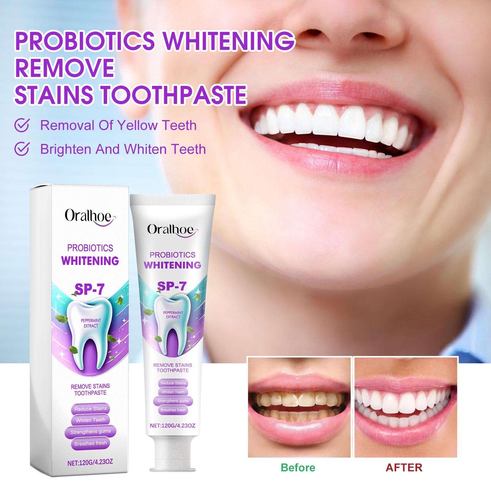 Probiotique Blanchiment Dentifrice 120g