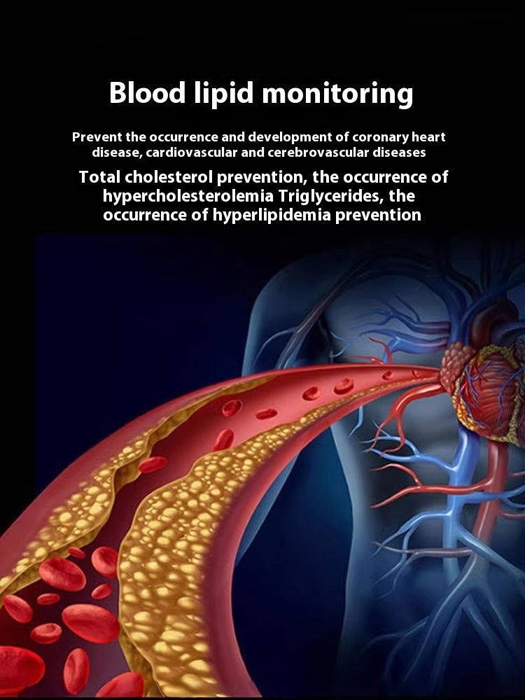 Montre de glycémie non invasive ECG Blood Pressure Heart Rate Smart Bracelet
