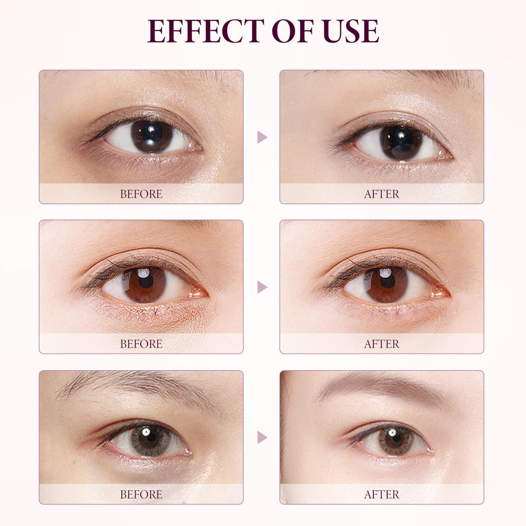 Mango Eye Cream Fading Wrinkle Fishtail Pattern