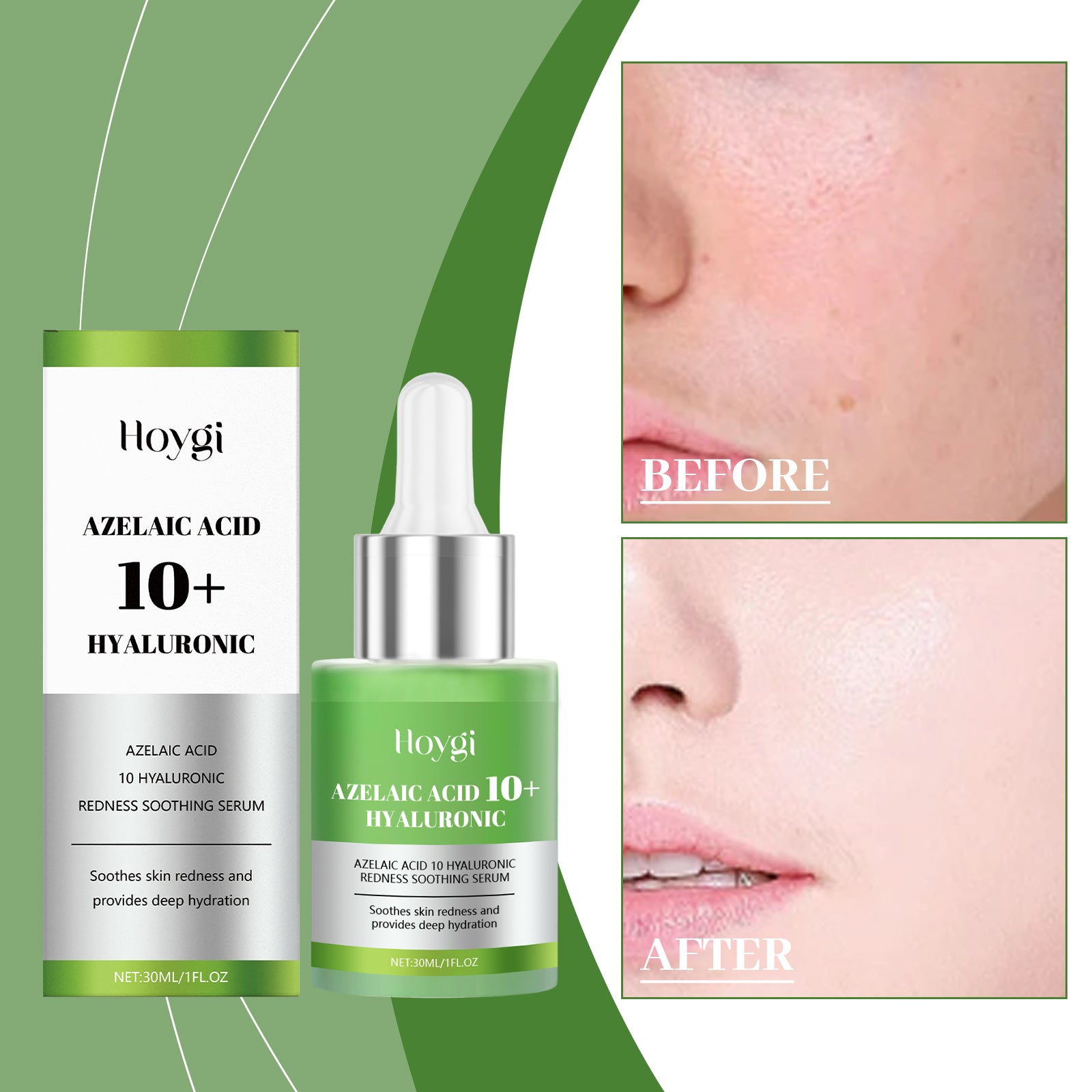 Acide hyaluronique Apaisant E Ssence Vert clair Boîte de 30ml