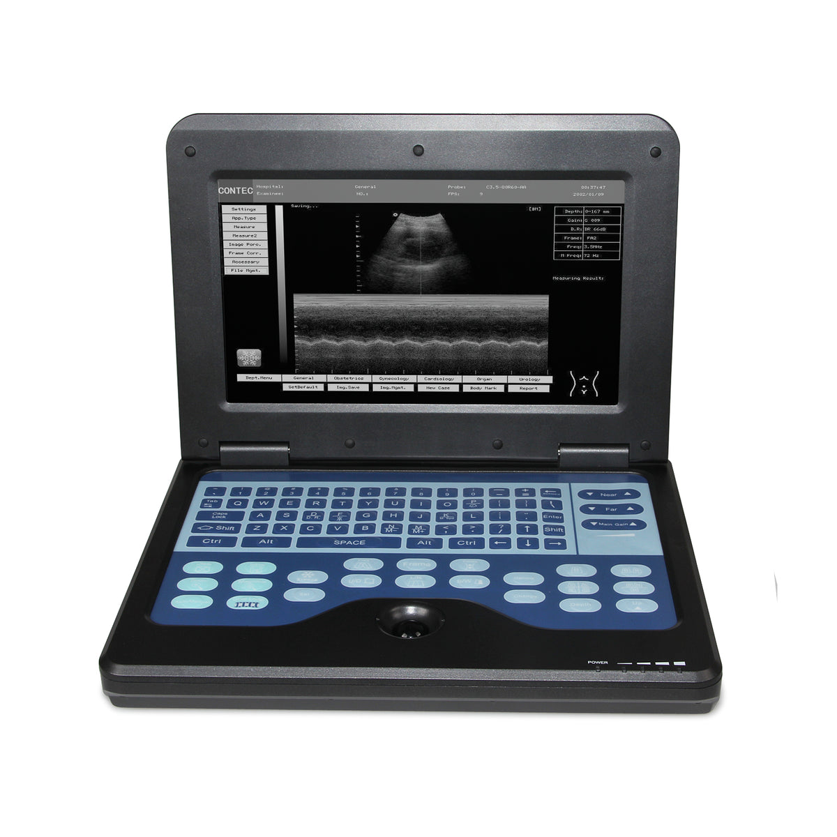 Détecteur à ultrasons portatif Ordinateur portable numérique de diagnostic 3.5 Convex sonde