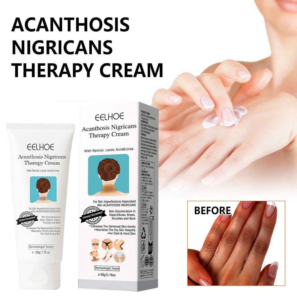 Blackthorn Skin Radiance Treatment Cream 50g-box