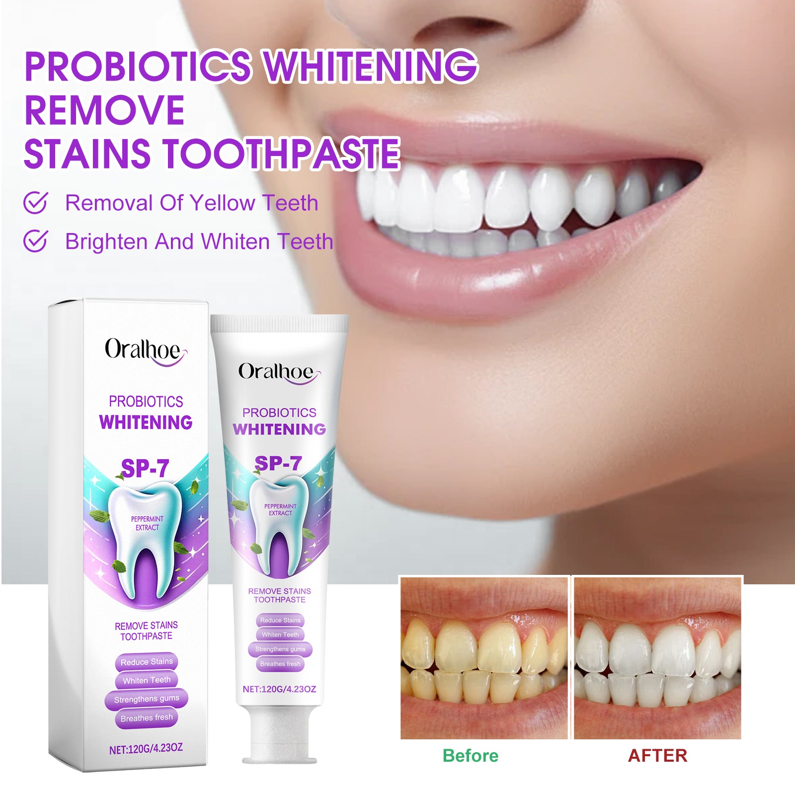 Probiotique Blanchiment Dentifrice 120g