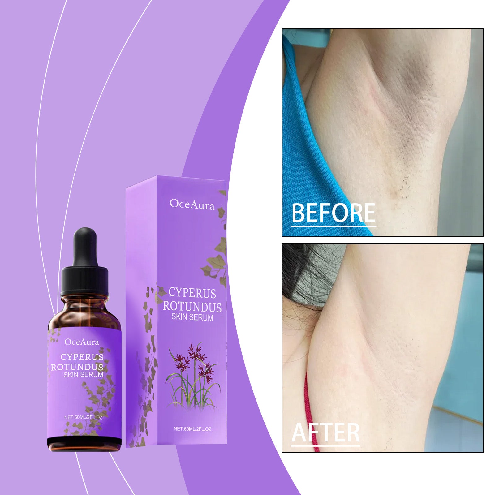 Réparation post-épilation E Ssence 60ml-box