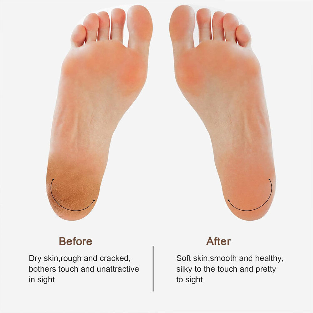 Fichier de pied électrique Rechargeable Callus Hard Skin Remover Pieds Pédicure 2 Vitesses