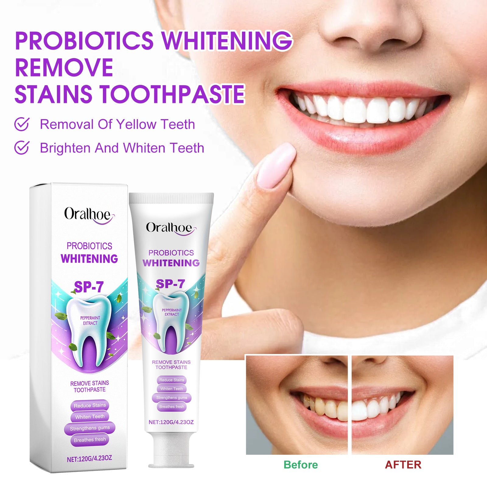 Probiotique Blanchiment Dentifrice 120g