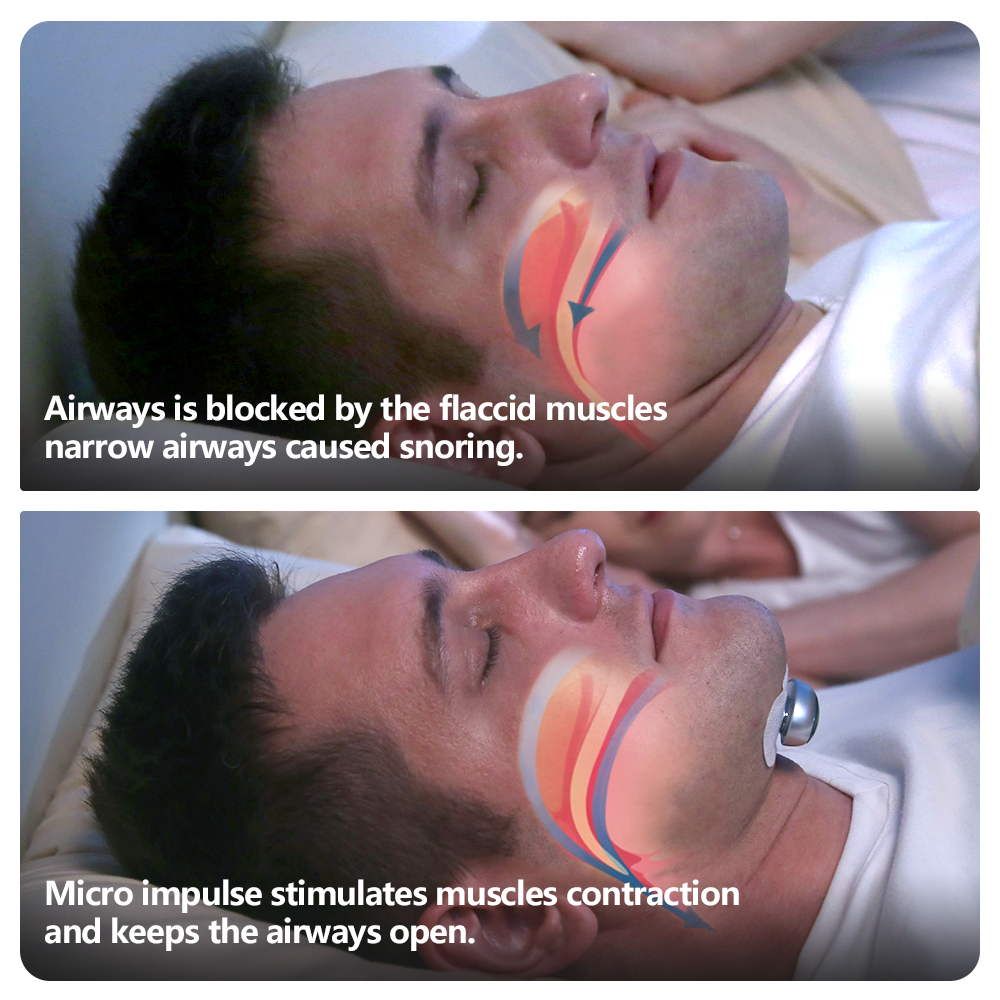Smart Anti Snoring Device Electronic Muscle Stimulateur Pro avec 20pcs bandes conductrices