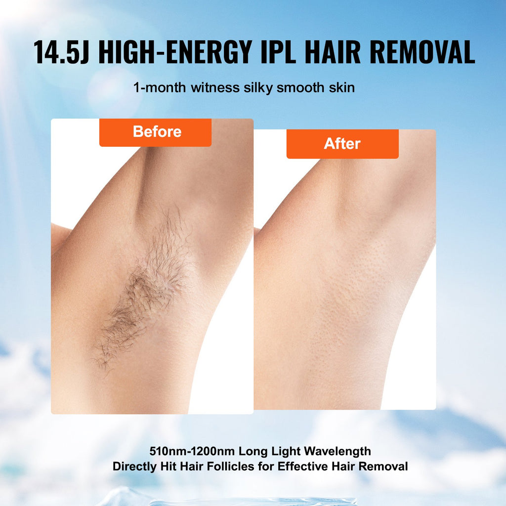 VEVOR IPL Enlèvement des cheveux