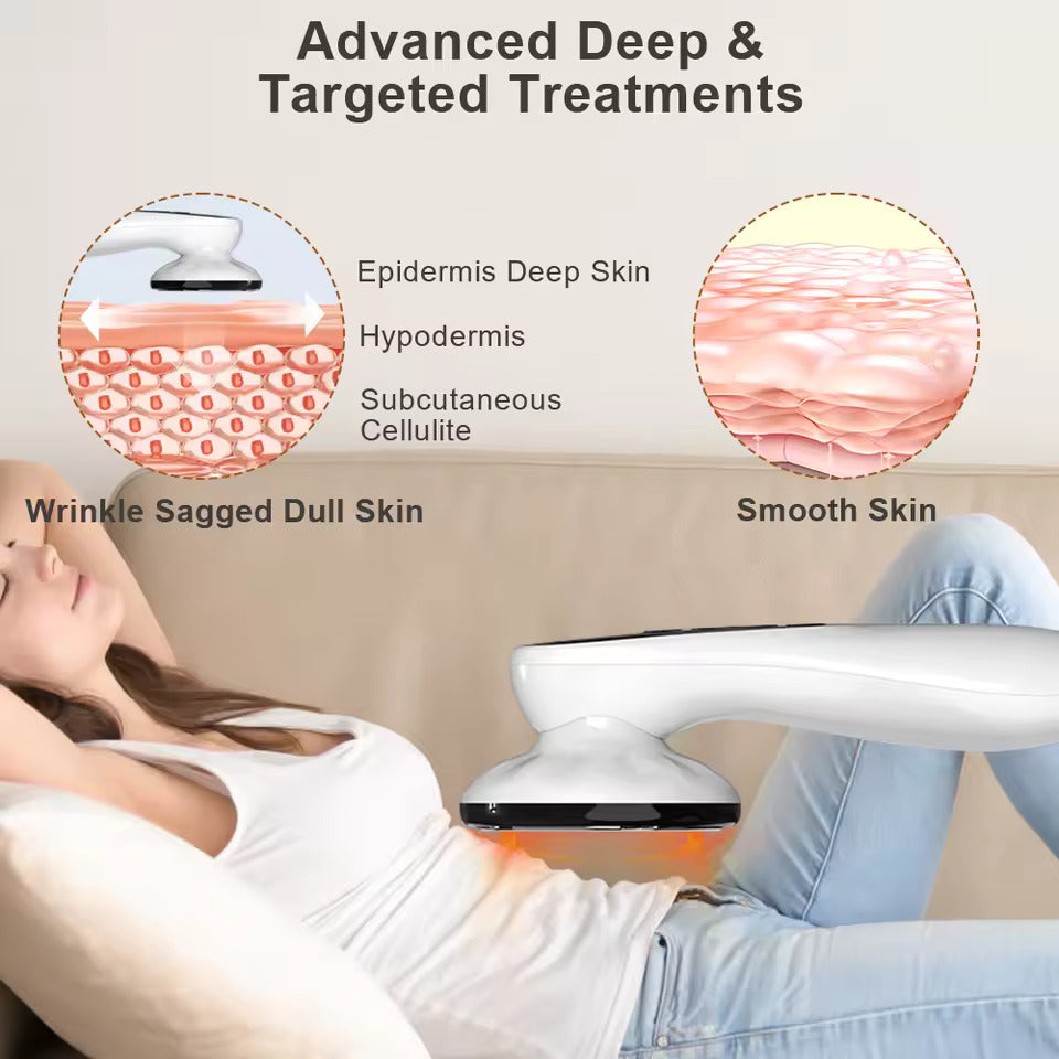 Masseur de celluliteAliExpress