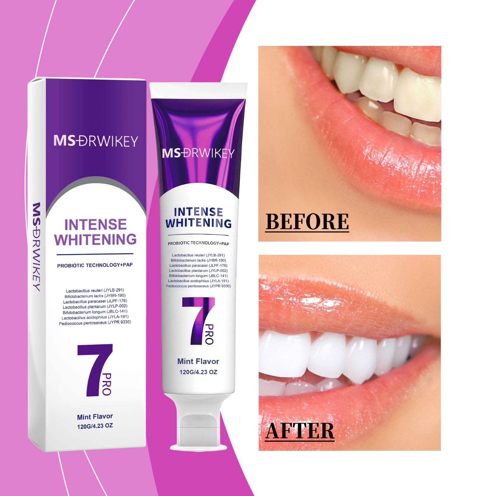 Dentifrice de blanchiment profond 120g 1box