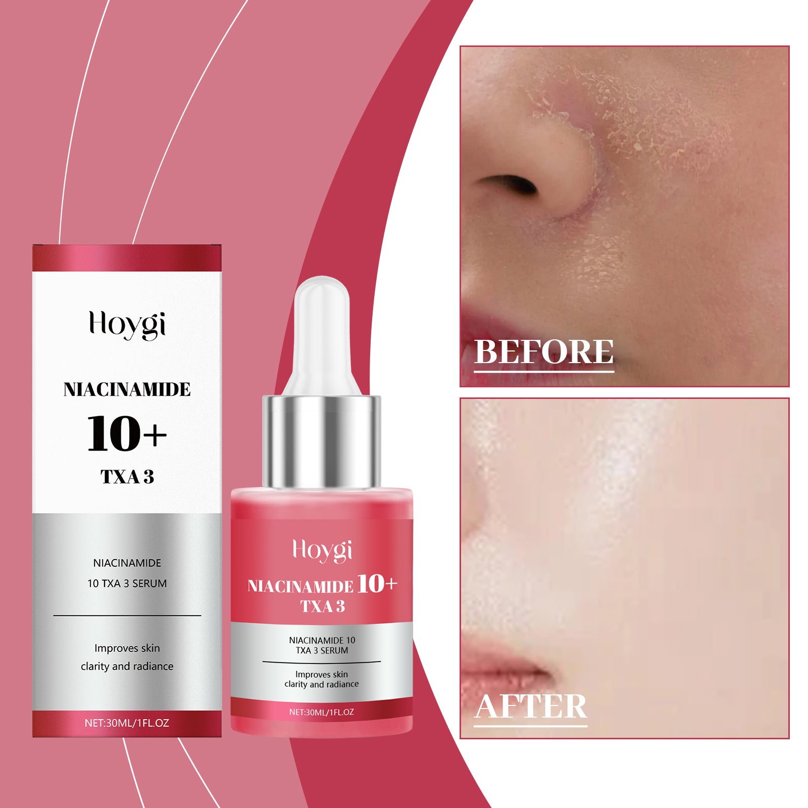 Acide hyaluronique Élargissement E Ssence P Encre 30ml-boîte