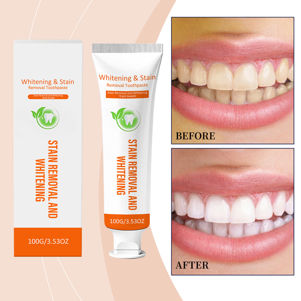 Dentifrice blanchissant doux 1 00g 1box