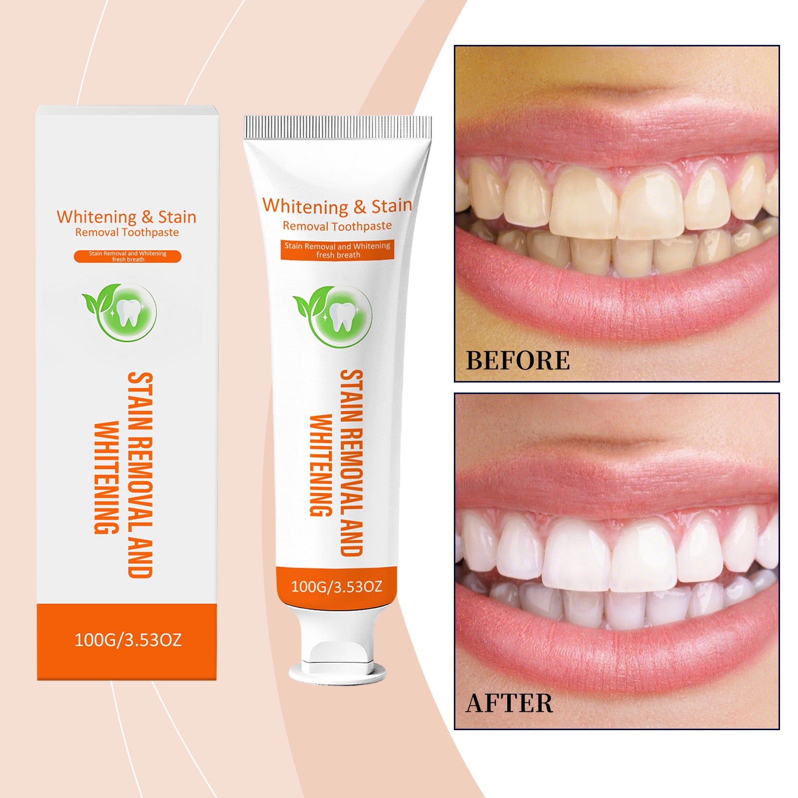 Dentifrice blanchissant doux 1 00g 1box
