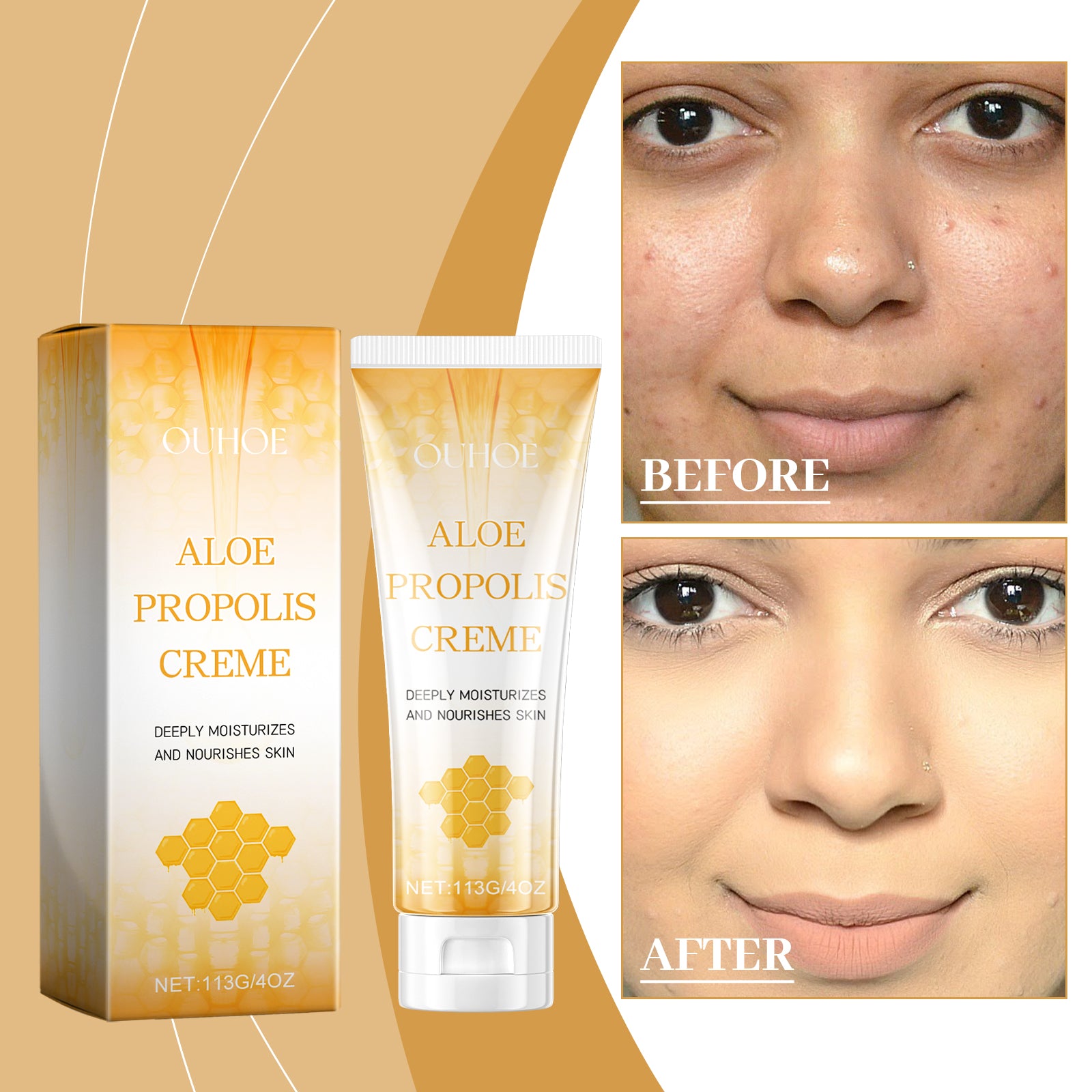 Aloe Propolis Crème hydratante 113g 1 Boîte