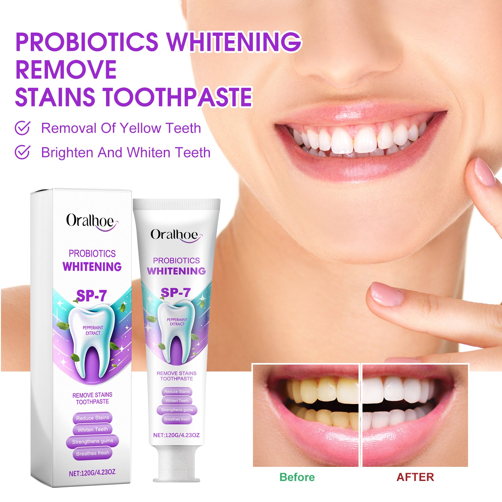 Probiotique Blanchiment Dentifrice 120g