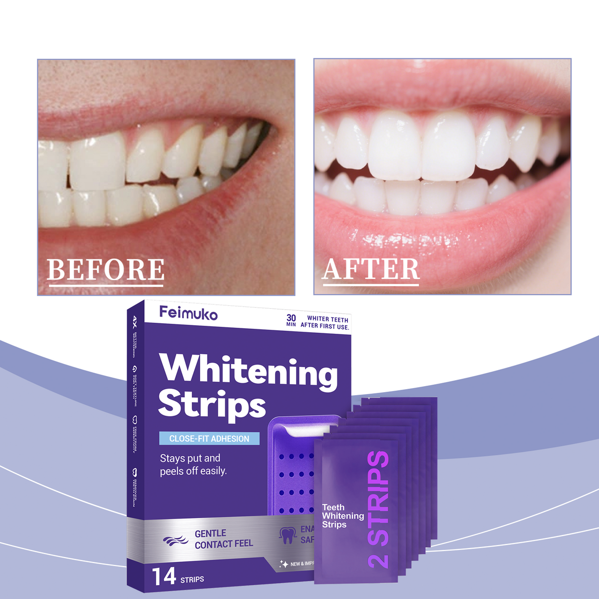 Stickers Dents Blanchiment Violet et Abancissement 7 Pièces par Pack