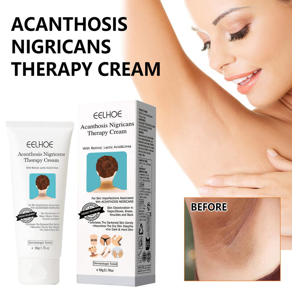 Blackthorn Skin Radiance Treatment Cream 50g-box