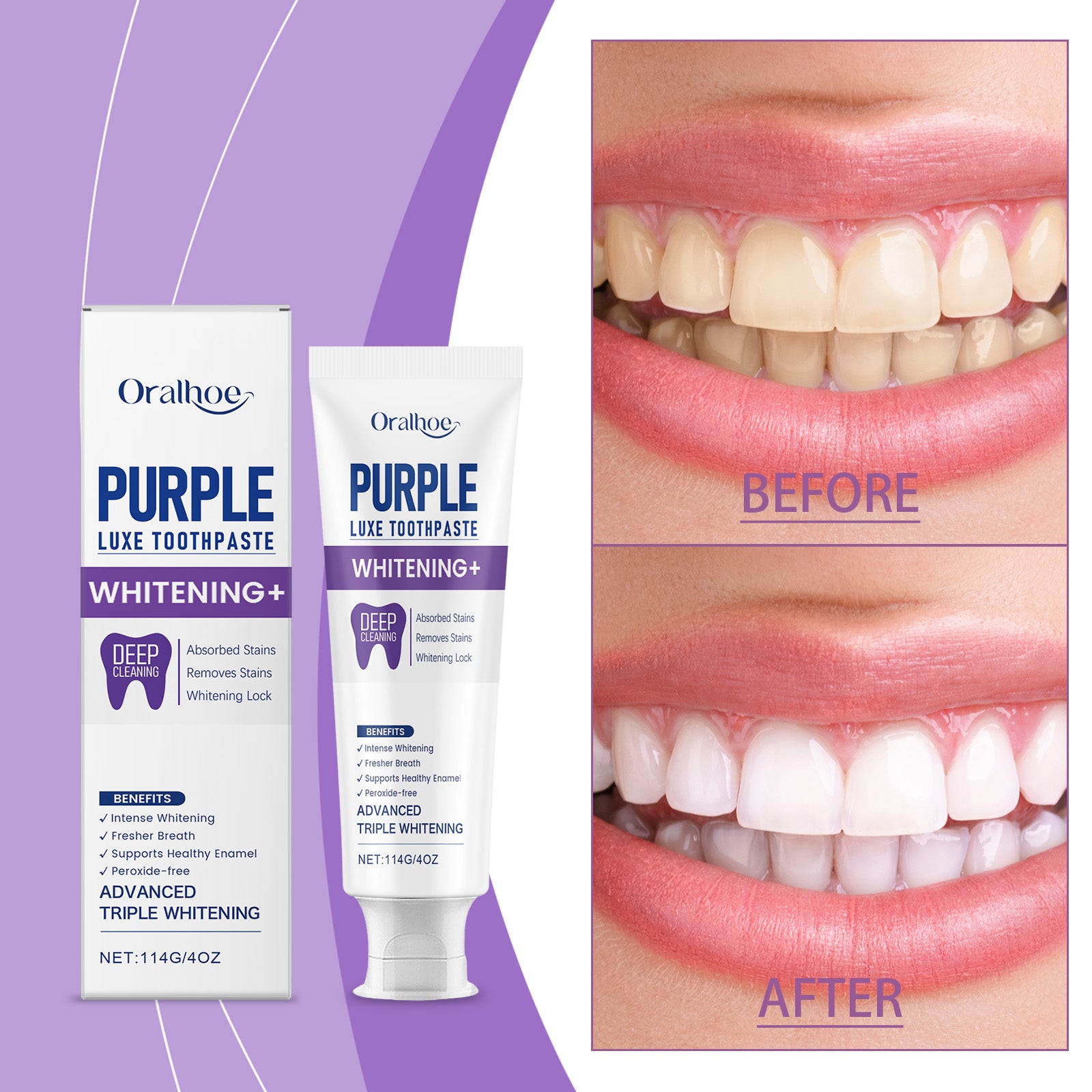 Blanchiment et brillance Dentifrice 114g-box