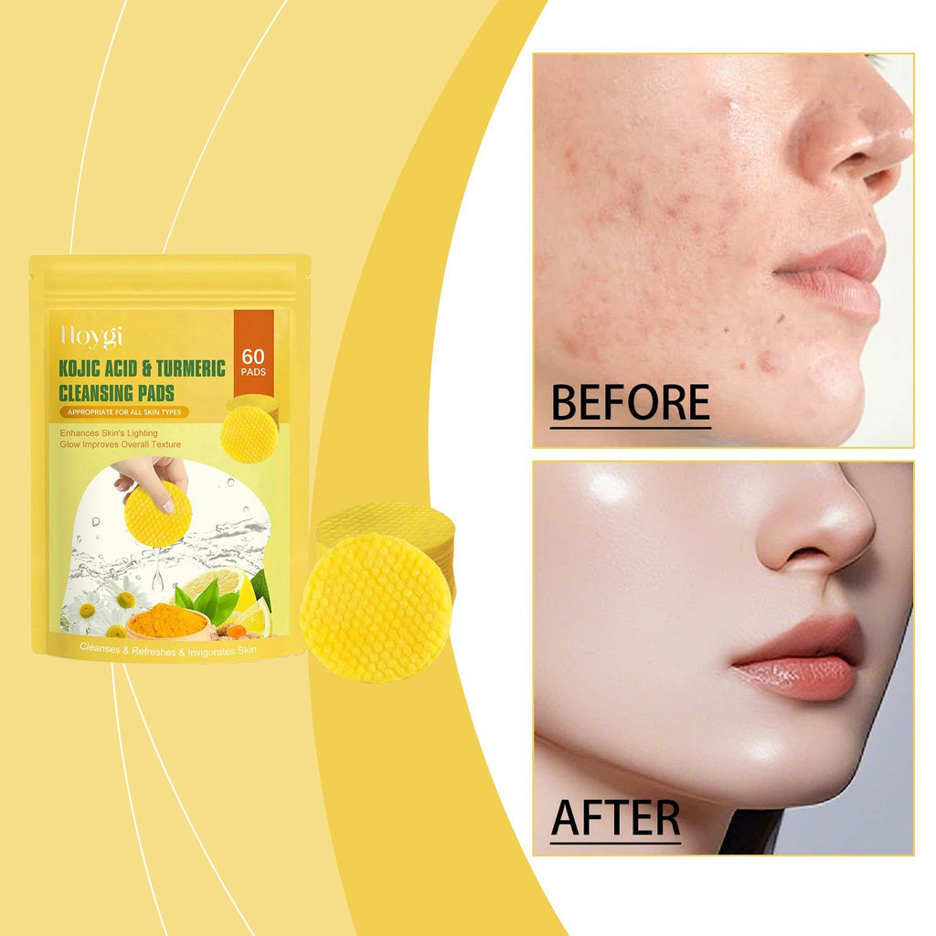 HOYGI Plaquettes de nettoyage du visage en curcuma et en acide Kojic