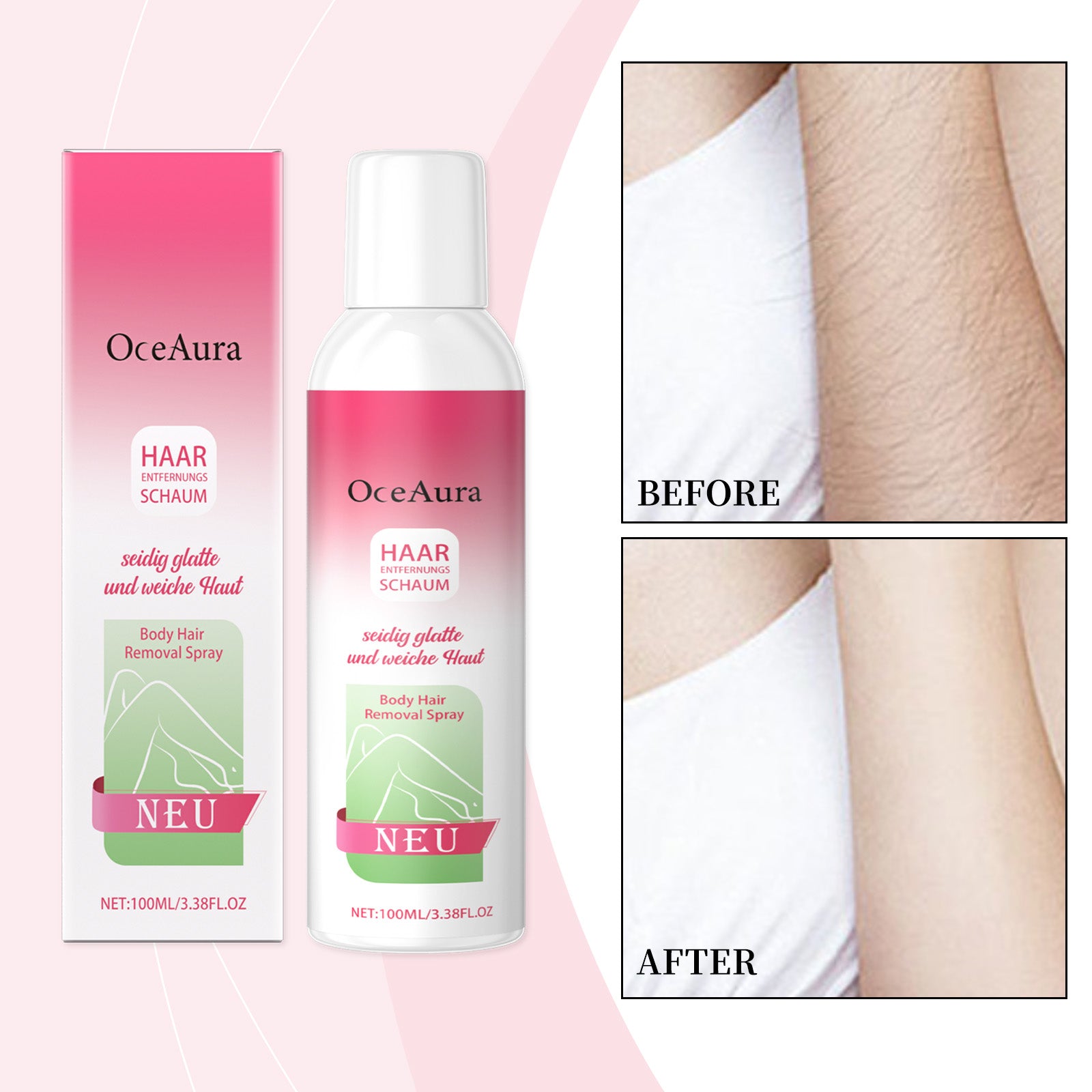 Spray d'enlèvement des cheveux du corps 1 00ml 1 boîte