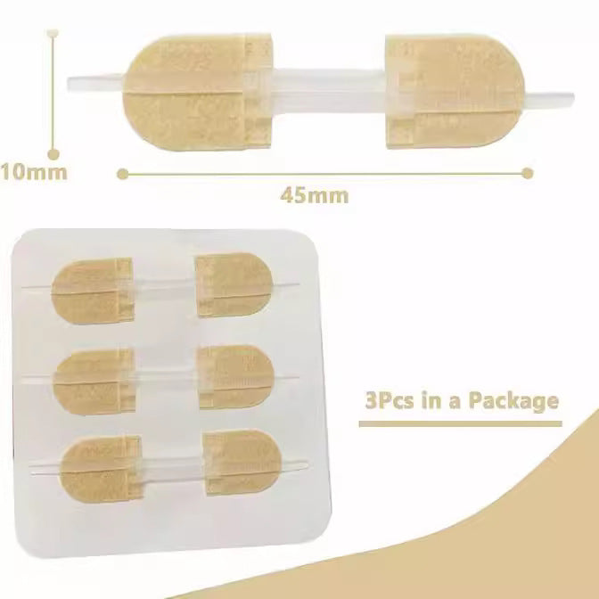Non-tissé Zipper Skin Stapler Wound Suture Patch Pull Bande autocollante