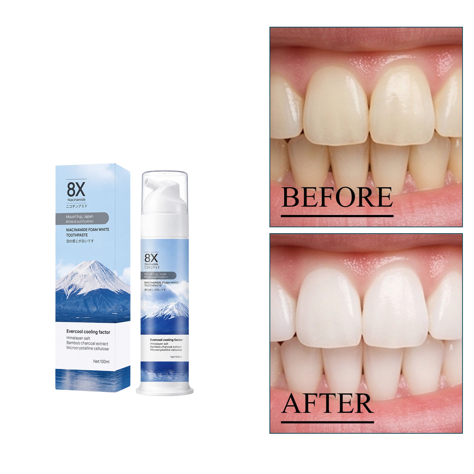 Niacinamide Dentifrice blanchissant 1 00ml 1 boîte