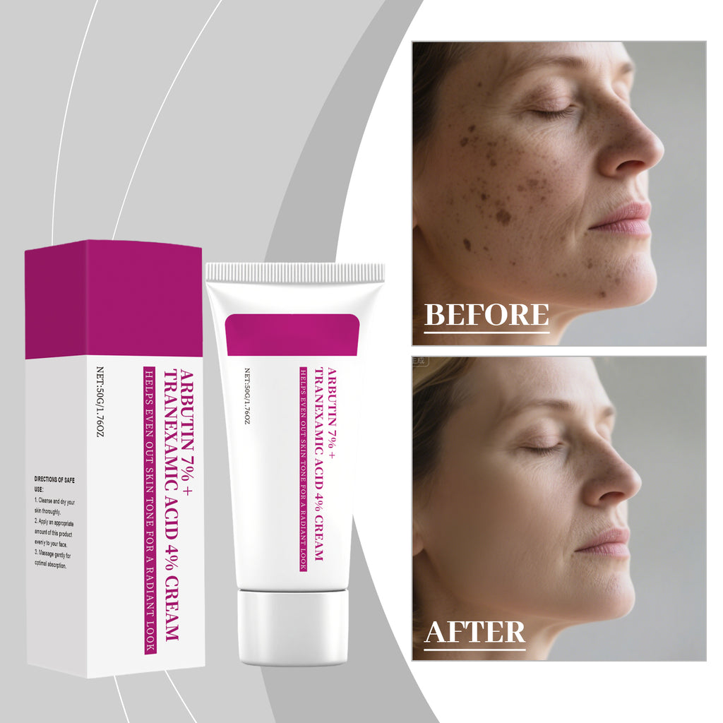 Arbutin Skin Care Cream 50g-box