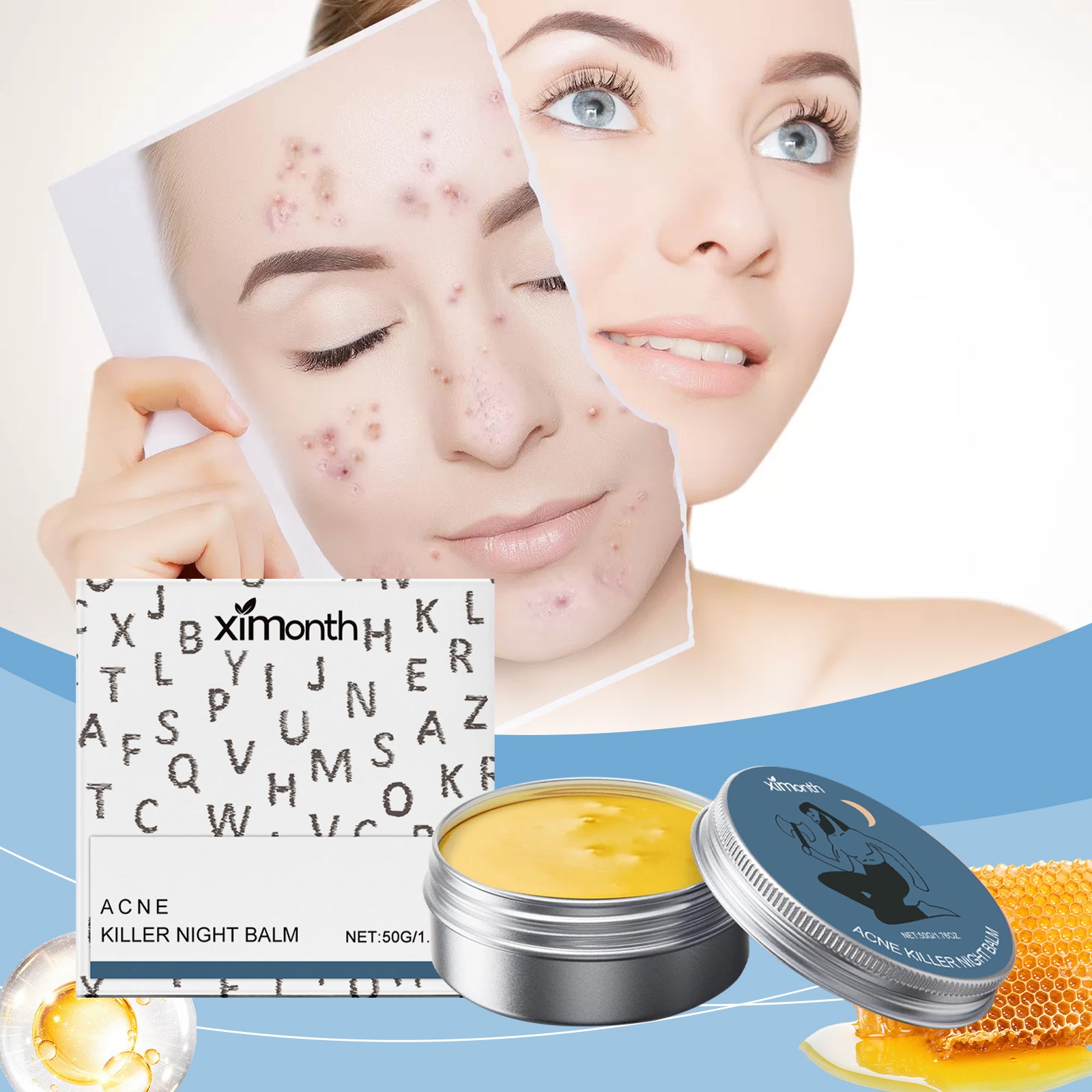 Crème d'acné hydratant 50g-boîte