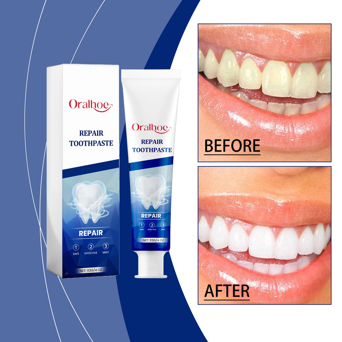 Probiotic Toothpaste for Fresh Breath and Whiter Teeth