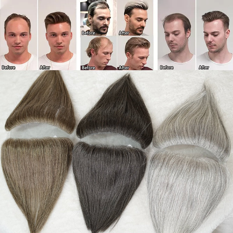 Stickers Perruque Homme Bang Sticker Scalp Invisible Pièce de complément cheveux