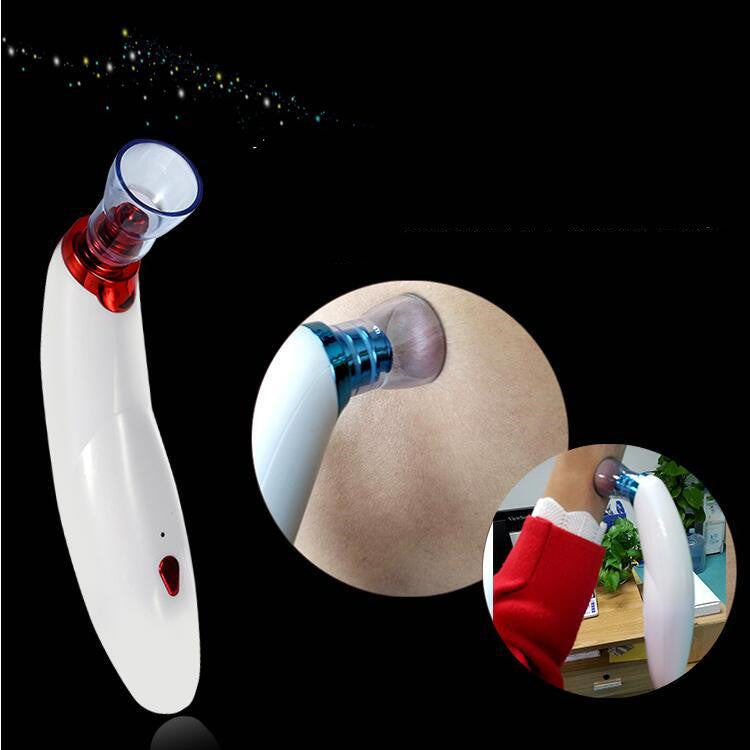 Dispositif d'aspiration électrique Blackhead pour supprimer l'acné
