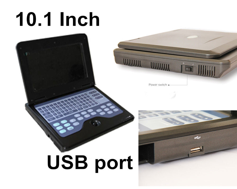 Détecteur à ultrasons portatif Ordinateur portable numérique de diagnostic 3.5 Convex sonde