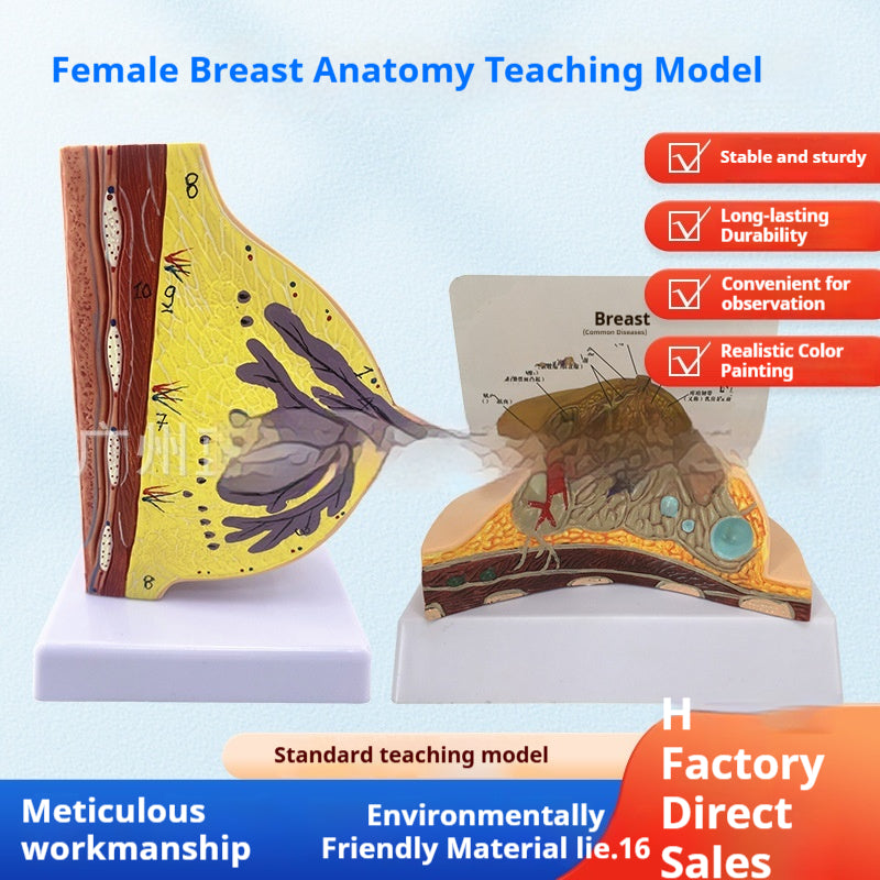 Anatomie mammaire féminine Modèle pathologique mammaire Allaitement Gynécologie Aide pédagogique
