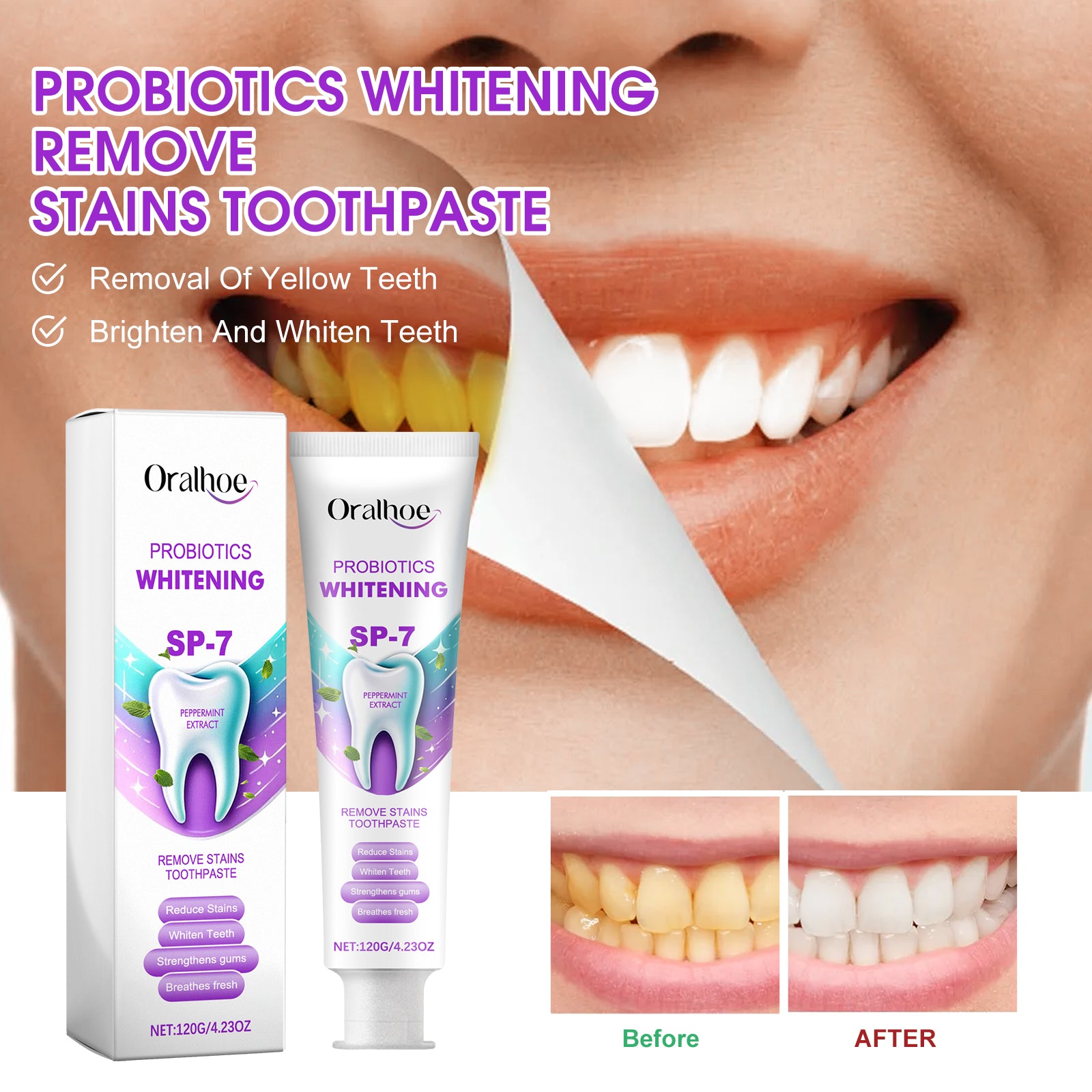 Probiotique Blanchiment Dentifrice 120g