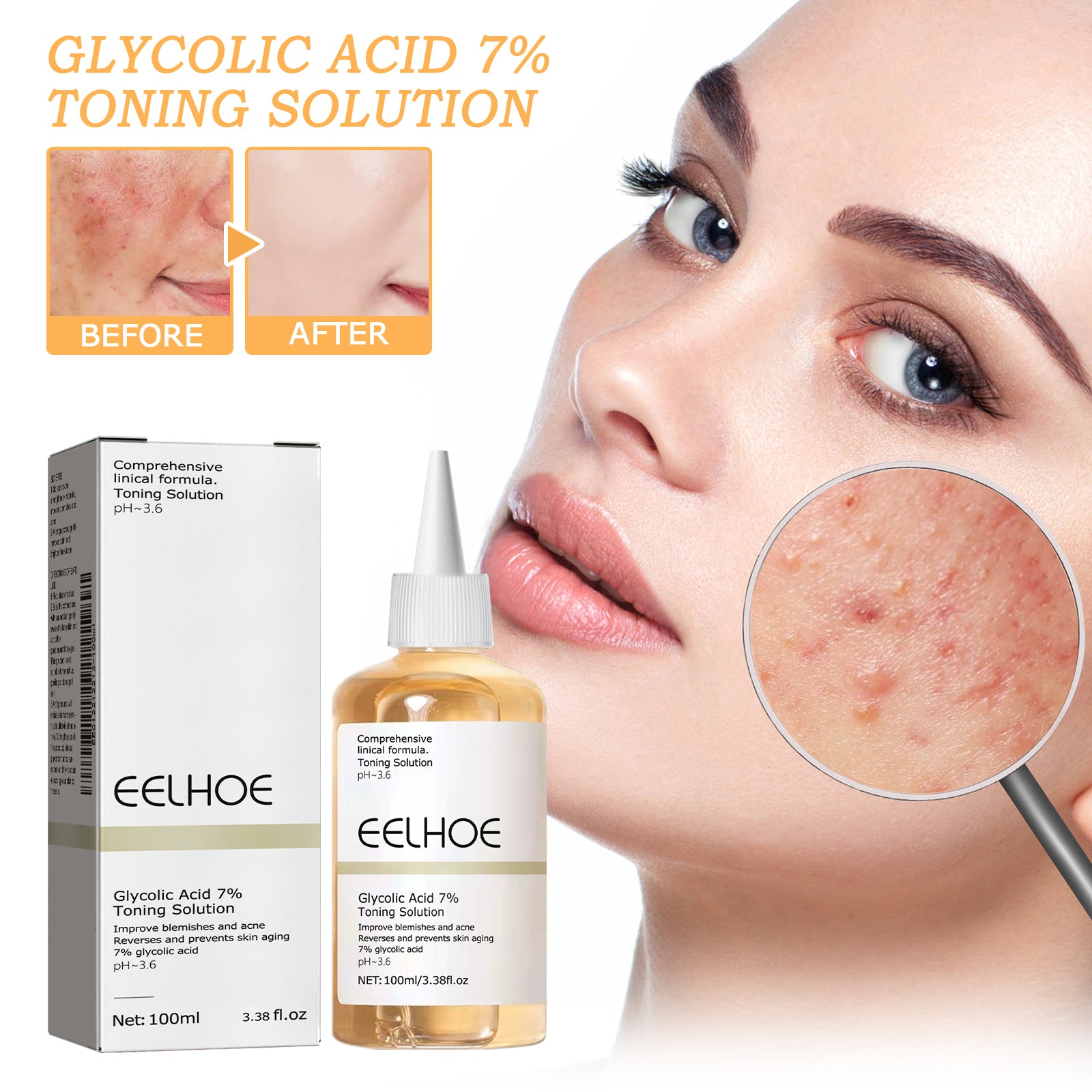 Acide glycolique 7 Toner 1 0 0ml-boîte