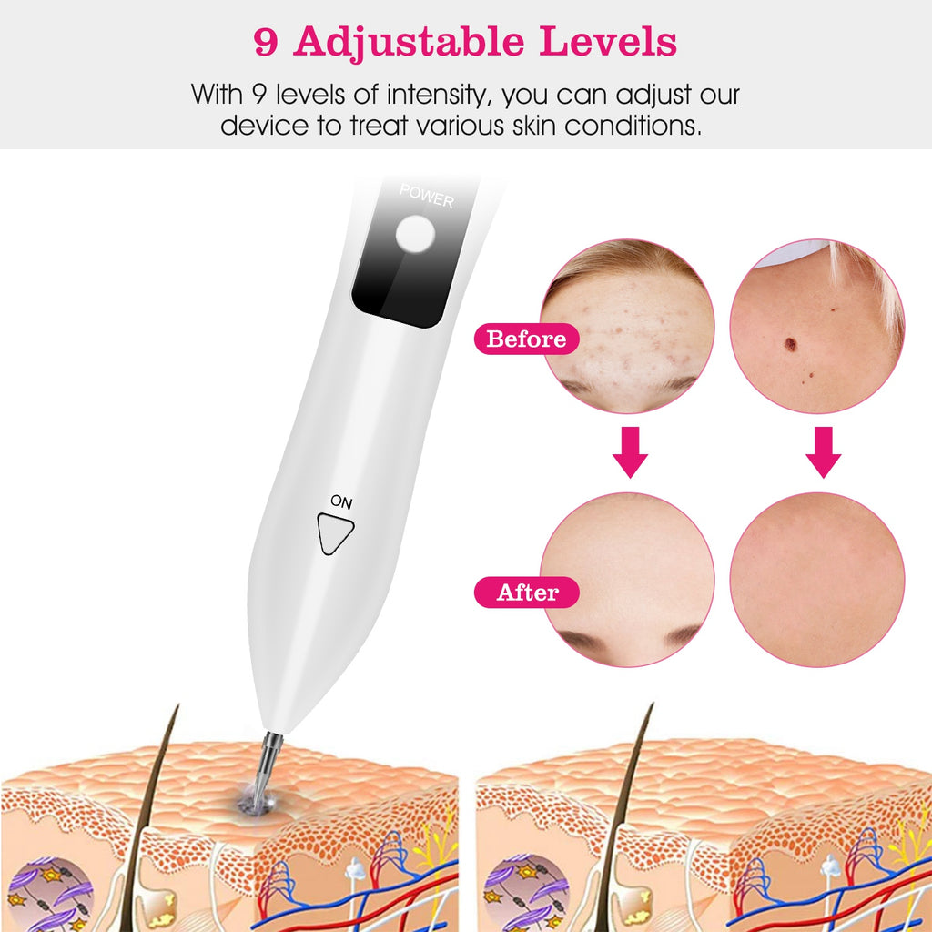 1Pc Skin Tag Kit de réparation Portable équipement de beauté multi-niveau avec usage à domicile USB charge